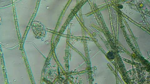 Spirogyra sp. Green Algae Under Microscopic View. Chlorophyta Stock Photos