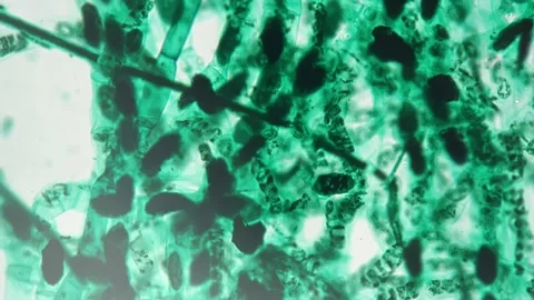 spirogyra conjugation under microscope