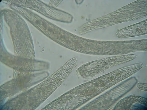 Spirostomum 200x Video stock 835257
