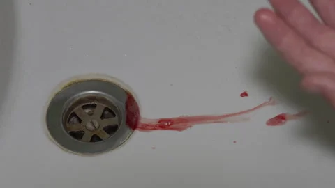 Spit blood washbasin Stock Footage 320824317