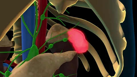 Spleen and lymphatic system lymph nodes anatomy for medical concept 3D rend.. Видео 307339656