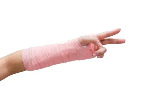Splint,broken bone,broken hand isolate on white background Stock Photos