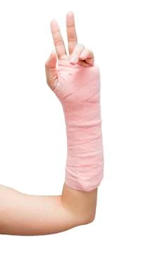 Splint,broken bone,broken hand isolate on white background Stock Photos