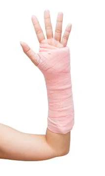 Splint,broken bone,broken hand isolate on white background Stock Photos