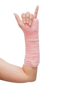 Splint,broken bone,broken hand isolate on white background 스톡 사진