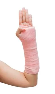Splint,broken bone,broken hand isolate on white background Stock Photos