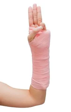 Splint,broken bone,broken hand isolate on white background Stock Photos