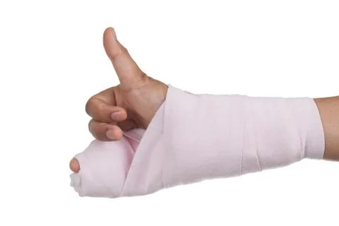 Splint,broken bone,broken hand Stock Photos