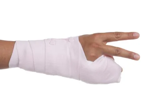 Splint,broken bone,broken hand Stock Photos