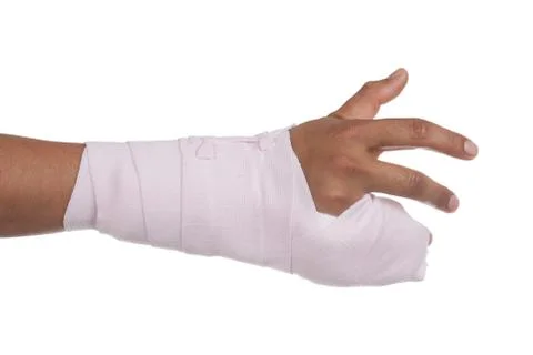 Splint,broken bone,broken hand Stock Photos