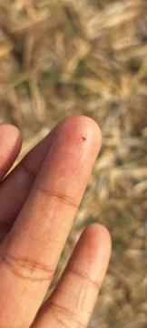A splinter in the finger close-up. Stock Photos