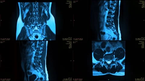 Split screen of four MRI images Stock Footage 126663352