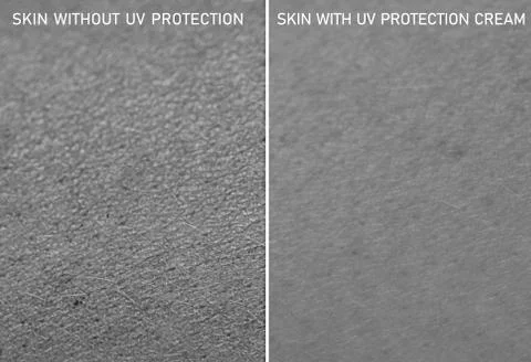 A split screen view showing the effects of sun damage on the skin. With and w 스톡 사진