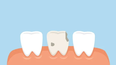 dental extraction cartoon