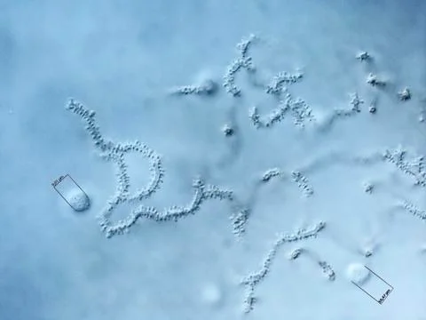 Spores of a slime mold. Microscopy Stock Photos