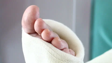 Sprain on a foot Stock-Footage 23167479