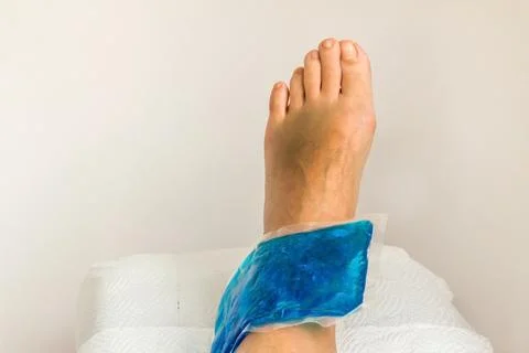 Sprained left ankle being treated with medical gel ice Stock Photos