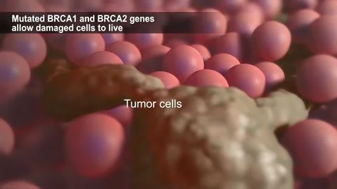 Spread of tumor cell Stock Illustration
