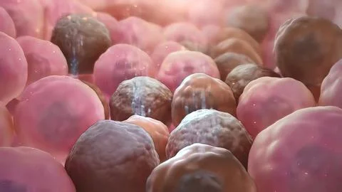 Spread of tumor cell Stock Illustration