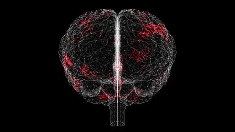 Spread of virus through 3D human brain on black background. Visual demonstr.. 스톡 일러스트