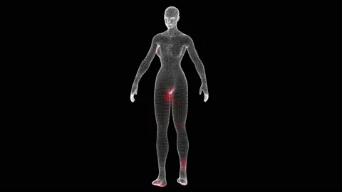 Spread of virus through volumetric body of woman rotation on black background 動画素材 235938945