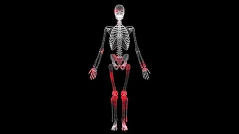 Spread of virus through volumetric skeleton monochrome on black background... Stock Illustration