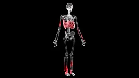 Spread of virus through volumetric skeleton monochrome on black background... Stock Illustration