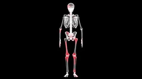 Spread of virus through volumetric skeleton monochrome on black background. V Stock Illustration