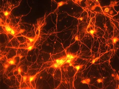  Sprouting connections in the brain: Adding GDF10 to neurons in a dish res... Stock Photos