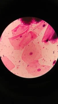 Squamous epithelial cells under microscope view Foto stock