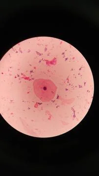 Squamous epithelial cells under microscope view Stock Photos