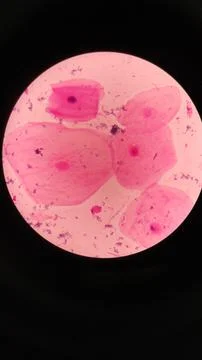 Squamous epithelial cells under microscope view Foto stock