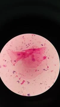 Squamous epithelial cells under microscope view Foto stock