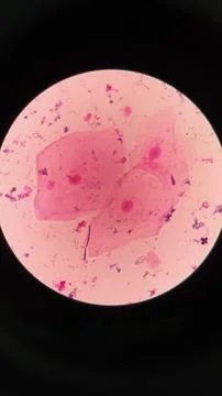 Squamous epithelial cells under microscope view Stock Photos