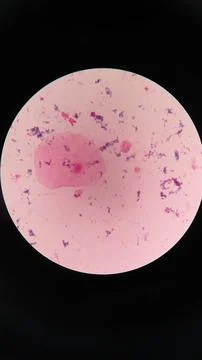 Squamous epithelial cells under microscope view Stock Photos