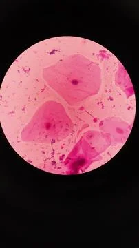Squamous epithelial cells under microscope view Foto stock