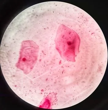 Squamous epithelial cells under microscope view Stock Photos