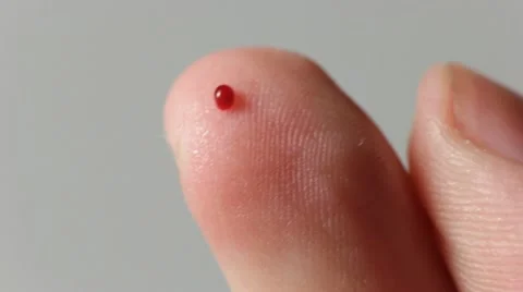 Squeeze out a blood drop Vídeos de archivo 12208984