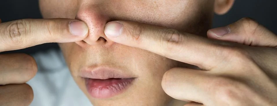 Squeezing acne on nose close up Stock Photos
