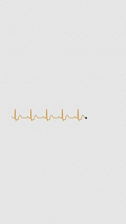 ST Depression ECG Heart Rhythm Clean No Text Alpha 4K Vertical 9x16 Light Stockbeeldmateriaal 339507142