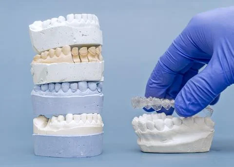 Stack of dental plaster casts and doctor hand putting transparent orthodontic Stock-Fotos
