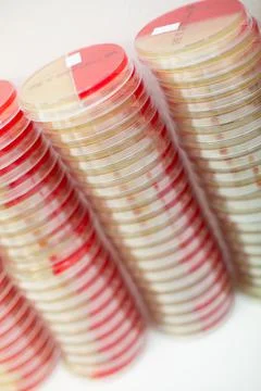 Stack of petri dishes with samples used in scientific expriment 库存照片