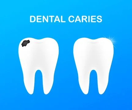Stage of development of caries. Dental care concept. Healthy Teeth. Vector il Stock Illustration