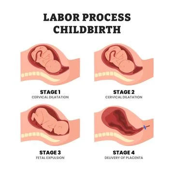 Stages of labor or childbirth process stages, educational medical poster de.. Illustrazione stock