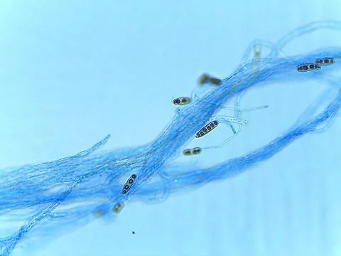 Stained Light Micrograph of Multispored Asci (Ascospores) within Hyphae, In.. Foto stock