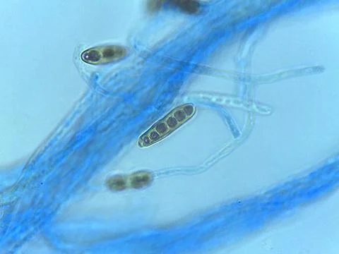 Stained Light Micrograph of Multispored Asci (Ascospores) within Hyphae, In.. Stock Photos