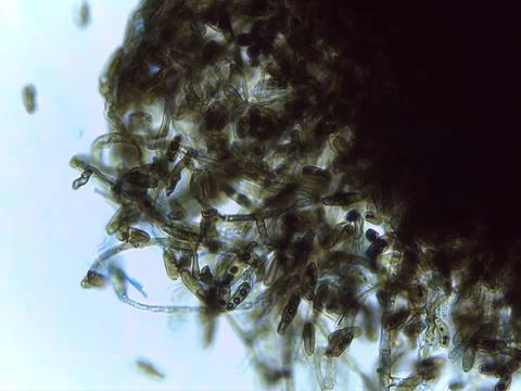 Stained Light Micrograph of Multispored Asci (Ascospores) within Hyphae, In.. 스톡 사진