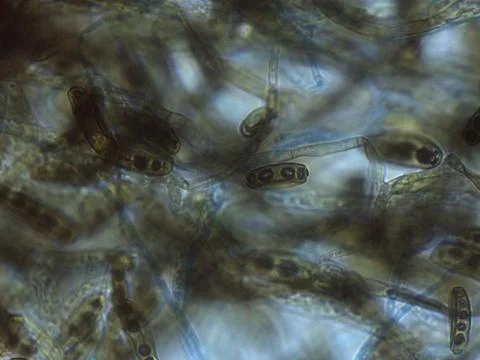 Stained Light Micrograph of Multispored Asci (Ascospores) within Hyphae, In.. 스톡 사진