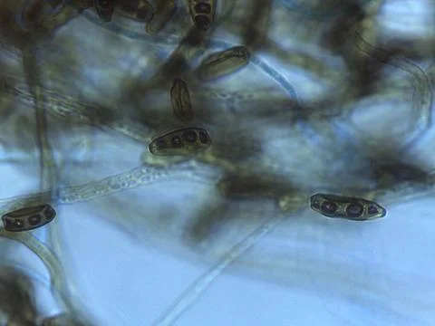 Stained Light Micrograph of Multispored Asci (Ascospores) within Hyphae, In.. 스톡 사진