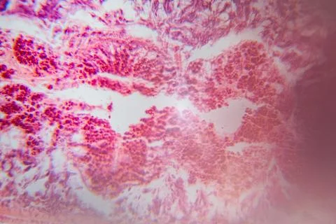 A stained micrograph of a human tissue sample in shades. Stock Photos